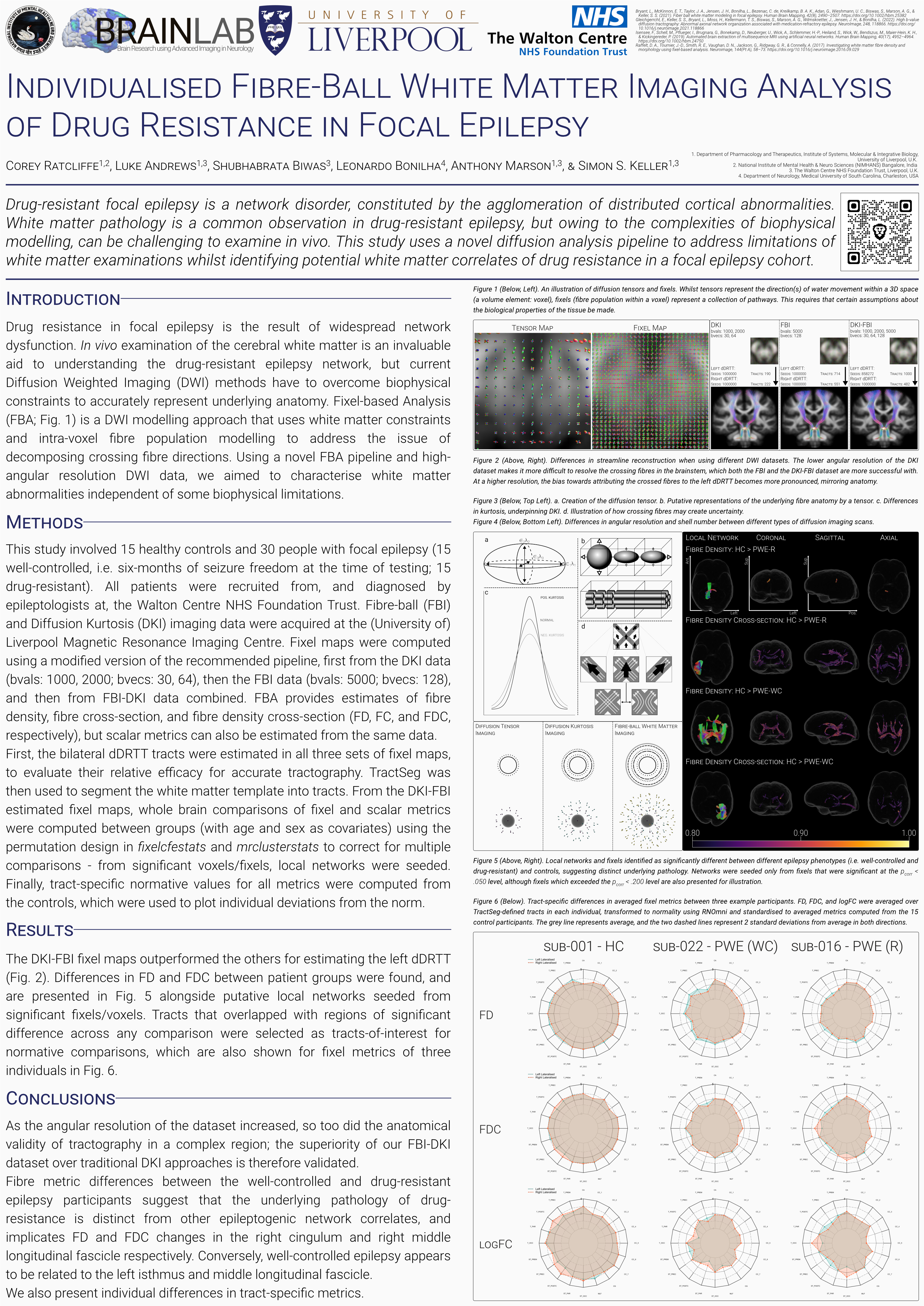 Individualised Fibre-Ball White Matter Imaging Analysis of Drug Resistance in Focal Epilepsy